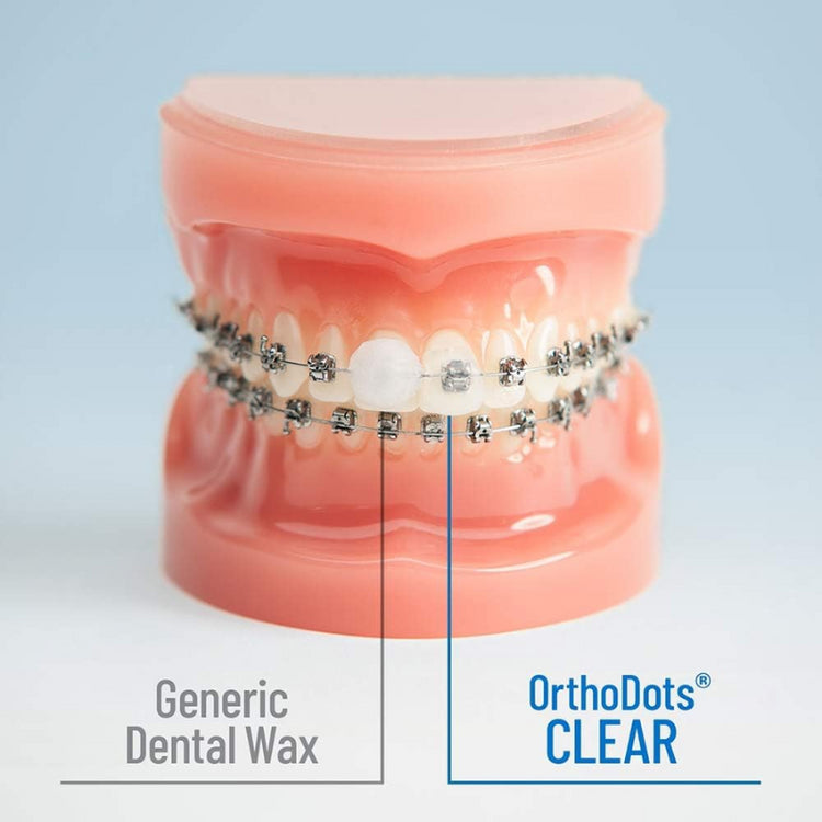 OrthoDots Dental Wax Clear