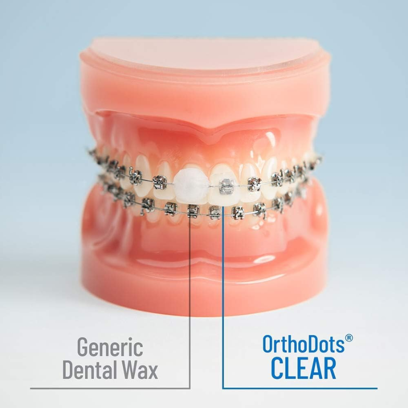 OrthoDots Dental Wax Clear