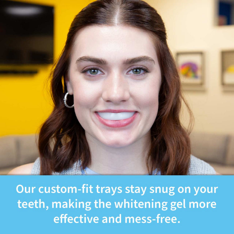 SOVA Teeth Whitening Kit Custom Fit Dental Trays