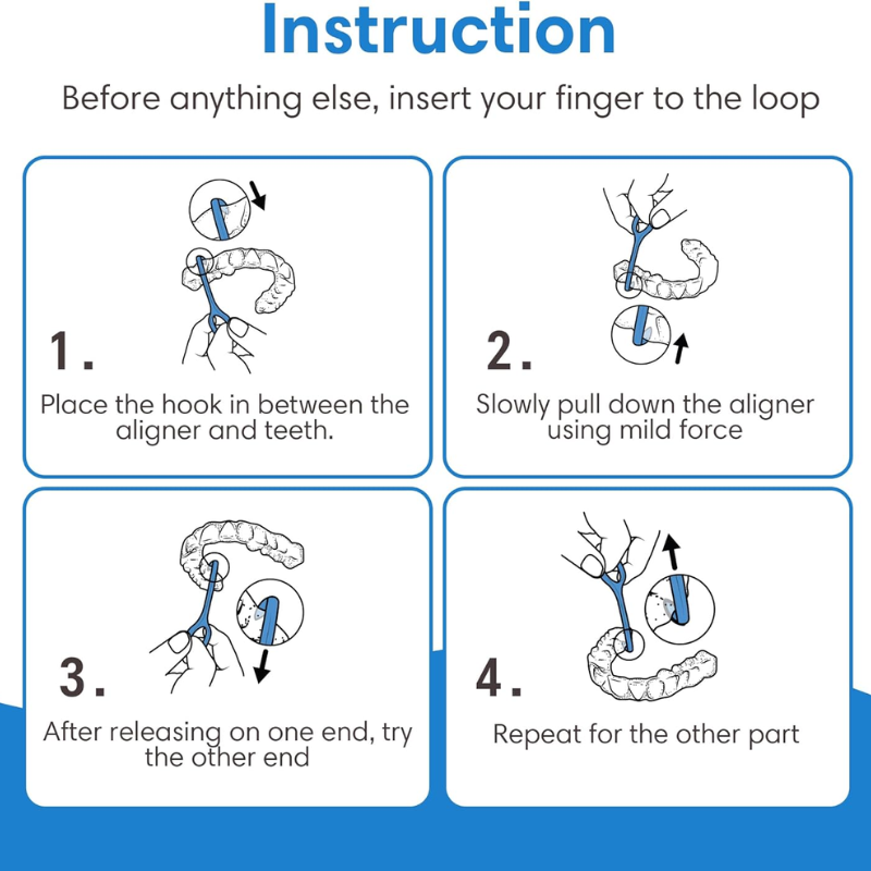 OrthoKey Aligner Removal Tool Instructions