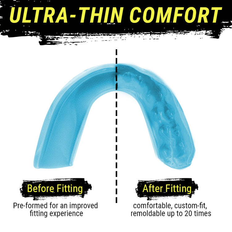 SISU 3D Sports Mouthguard Before and After Fitting