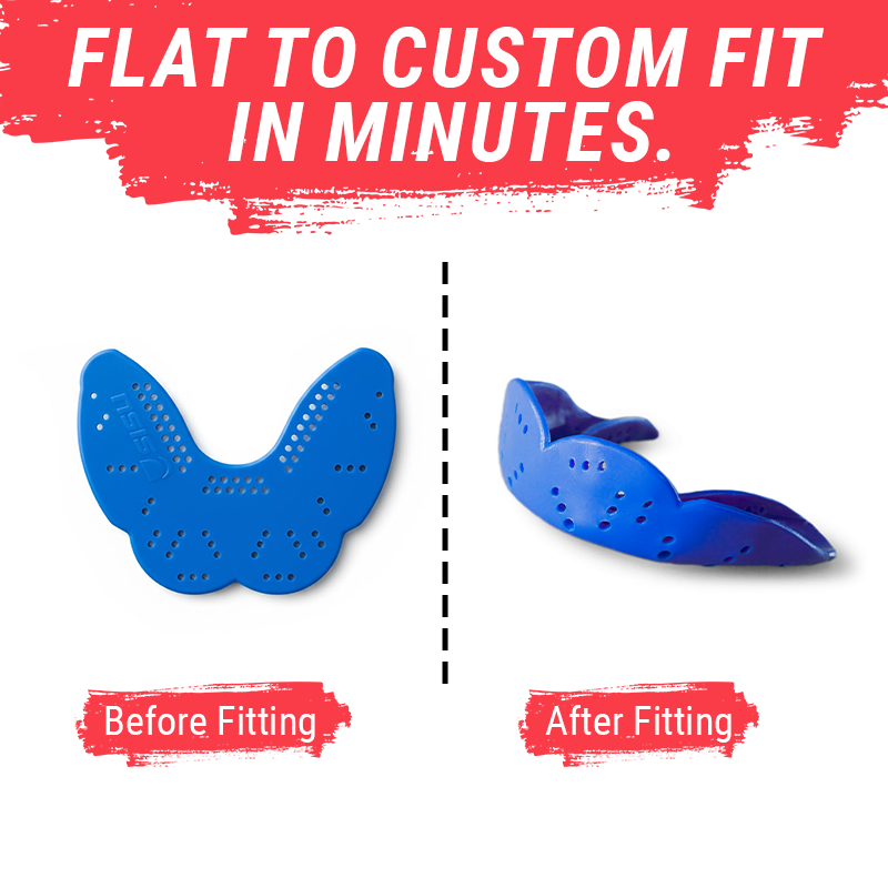 SISU Aero Sports Mouthguard Before and After Fitting