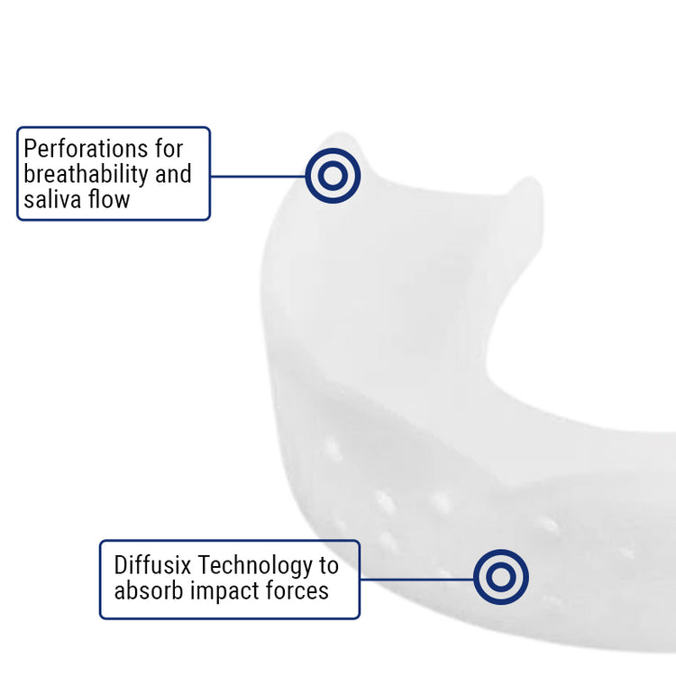 SOVA 3D Night Guard Perforations and Impact Forces
