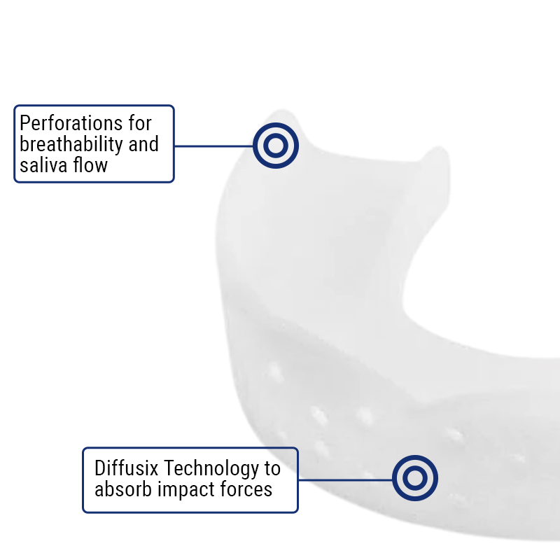 SOVA 3D Night Guard Perforations and Impact Forces