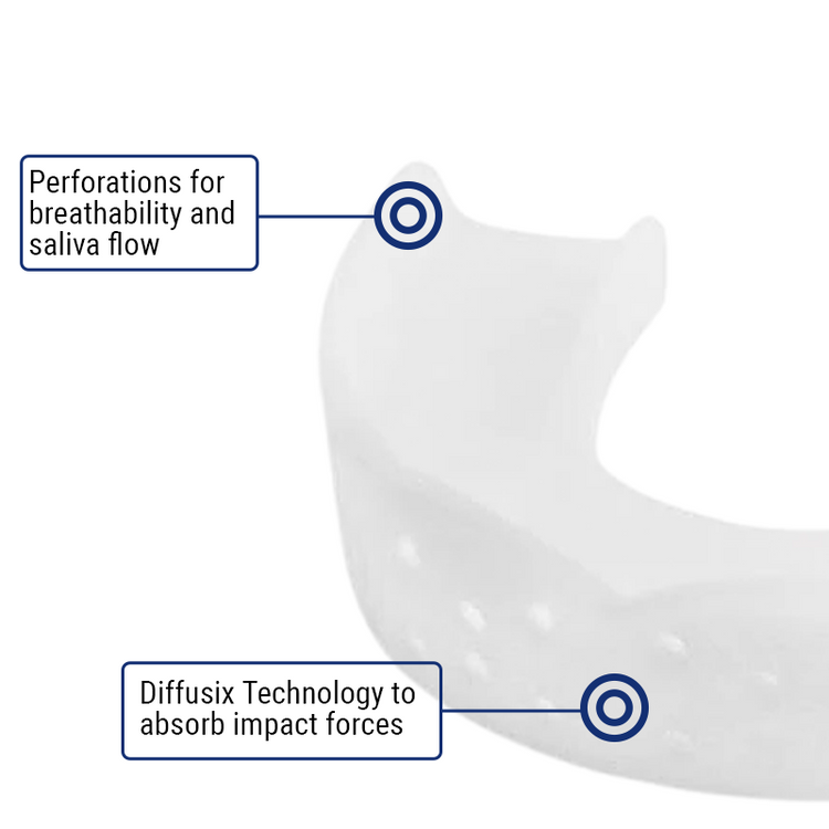 SOVA 3D Night Guard Perforations and Impact Forces