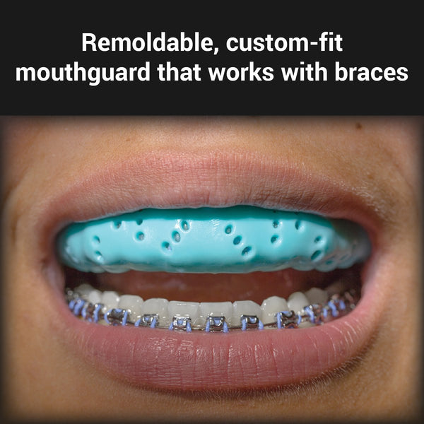 SISU Mouthguard Use With Braces