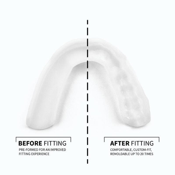 SOVA 3D Before & After APAC Dental